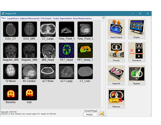 AnalyzeDirect : 3D Medical Image Analysis Software for Research